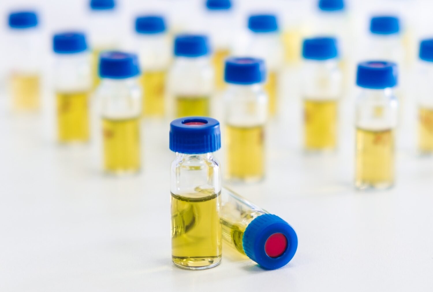 Test tubes with urine sample for HPLC analysis in the laboratory