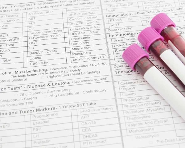 hplc used in the pharmaceutical industry heres how.jpg 2