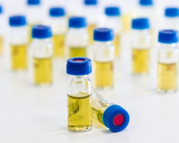 Test tubes with urine sample for HPLC analysis in the laboratory